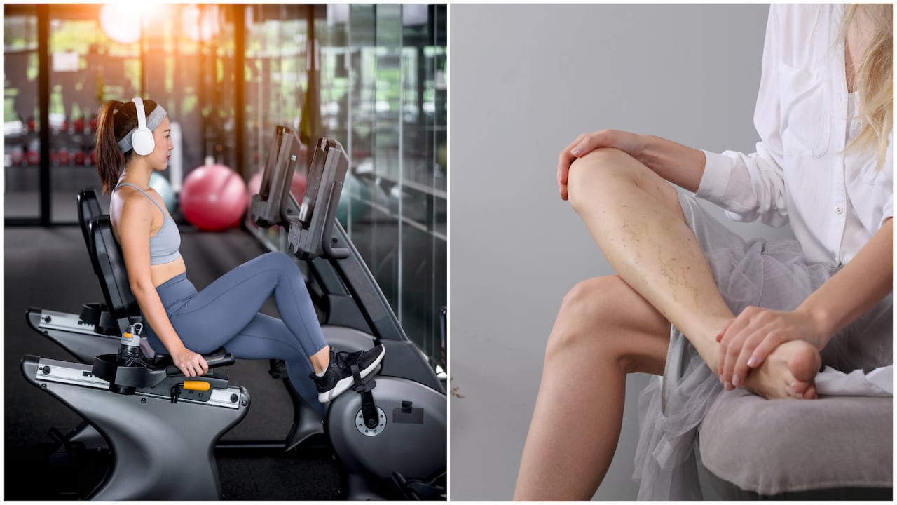 Las venas varices pueden producirse por diversas causas.