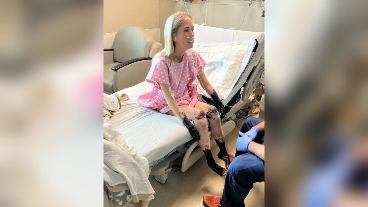 La profesora tuvo que ser sometida a un coma inducido.