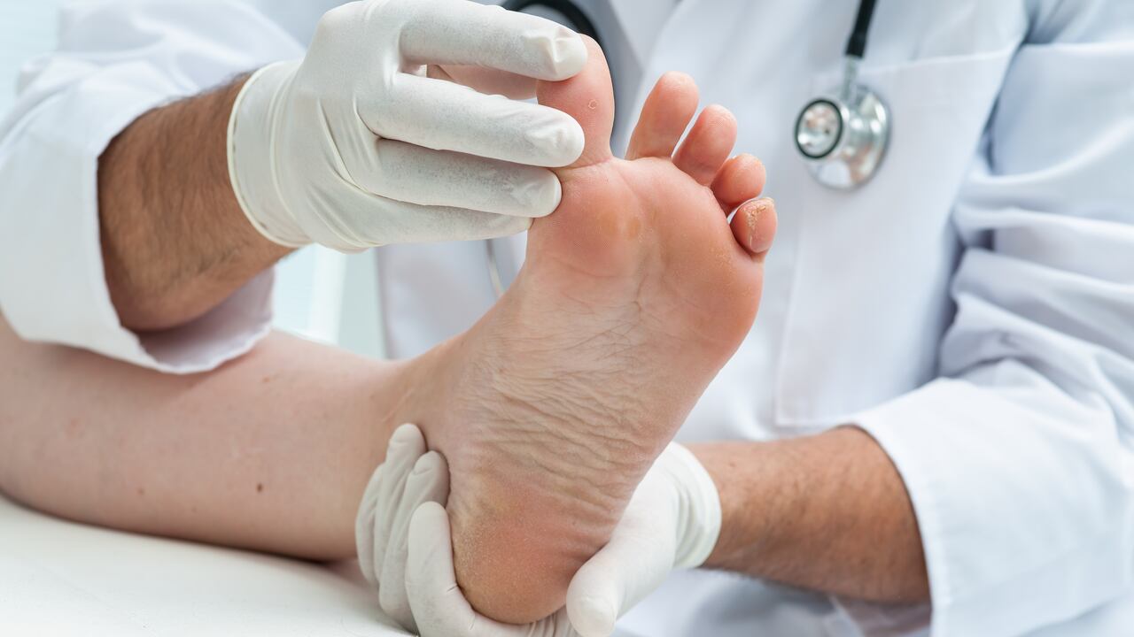 Doctor dermatologist examines the foot on the presence of athlete's foot