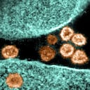 Variante iota, advierten cómo esta nueva cepa del coronavirus se expande con mayor rapidez