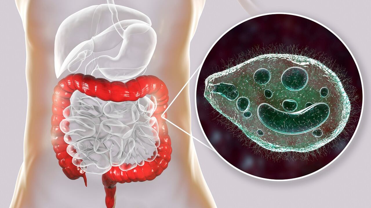 Los parásitos intestinales pueden generan diversas afecciones de salud.