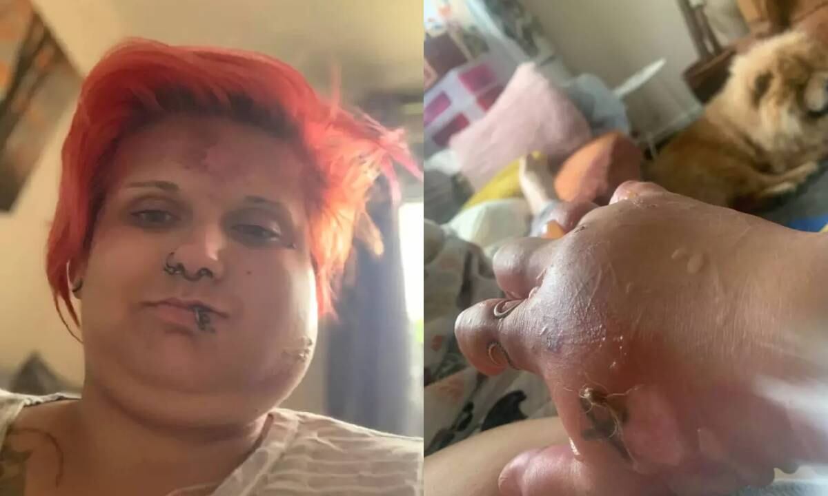 La mujer se sintió aterrorizada cuando vio la hinchazón en su rostro y su mano