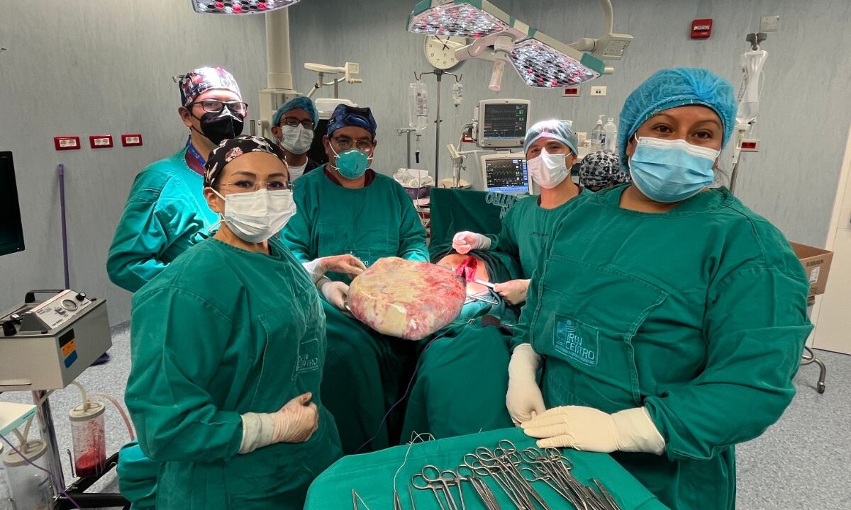 Tras ser extirpada, a gigantesca masa fue enviada a patología