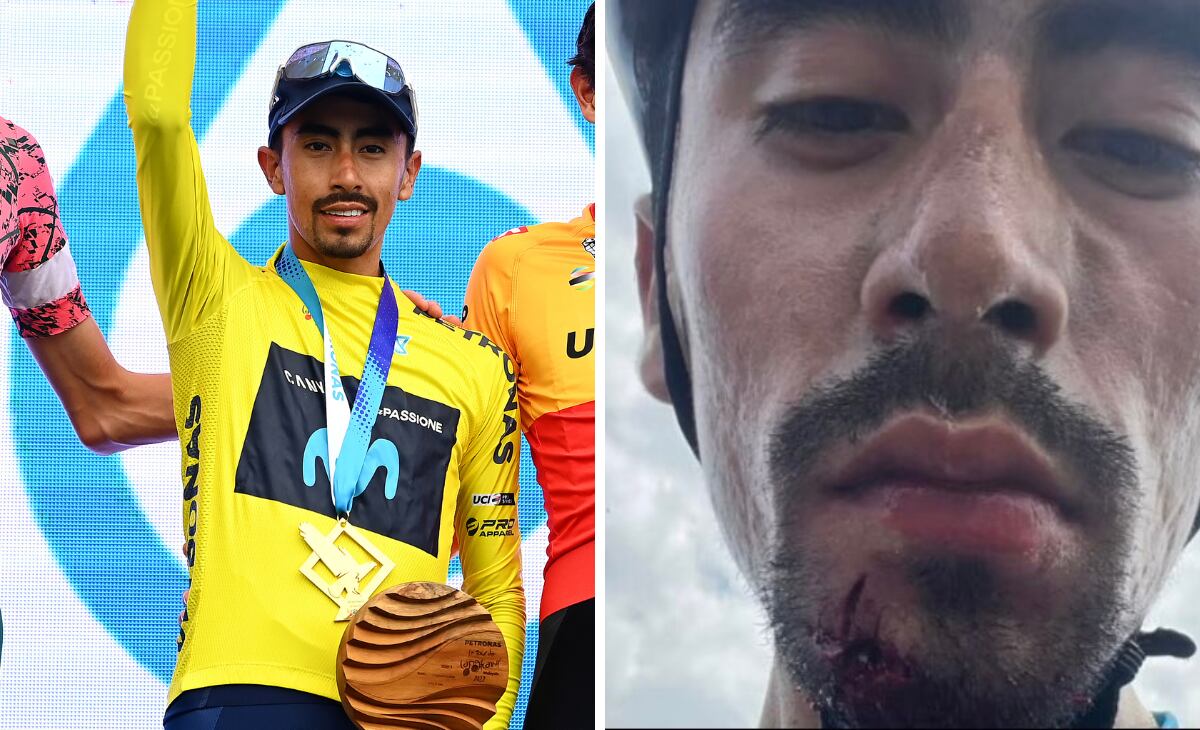 Iván Ramiro Sosa tras el accidente.