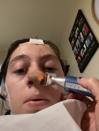 Trinity cuenta que todavía le crece pelo en la nariz, aunque ahora lo afeita para que no se note.