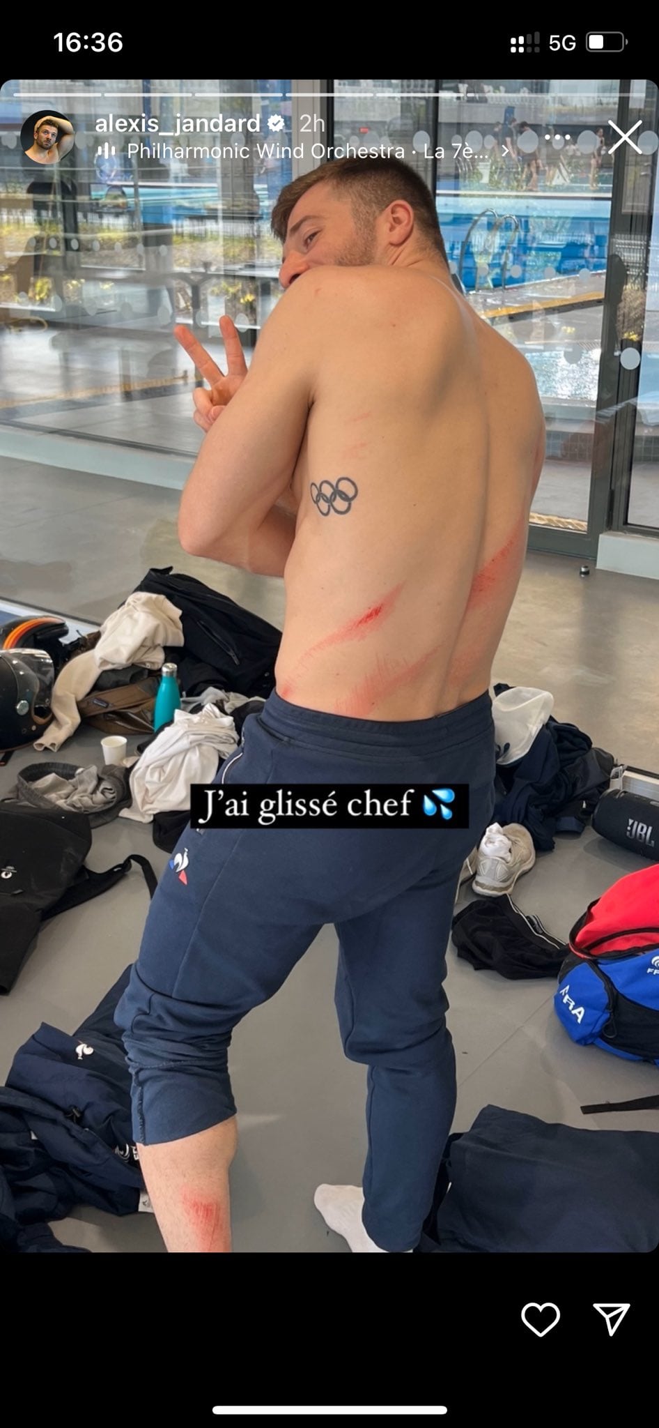 El deportista publicó en sus redes sociales las heridas que le quedaron tras el incidente