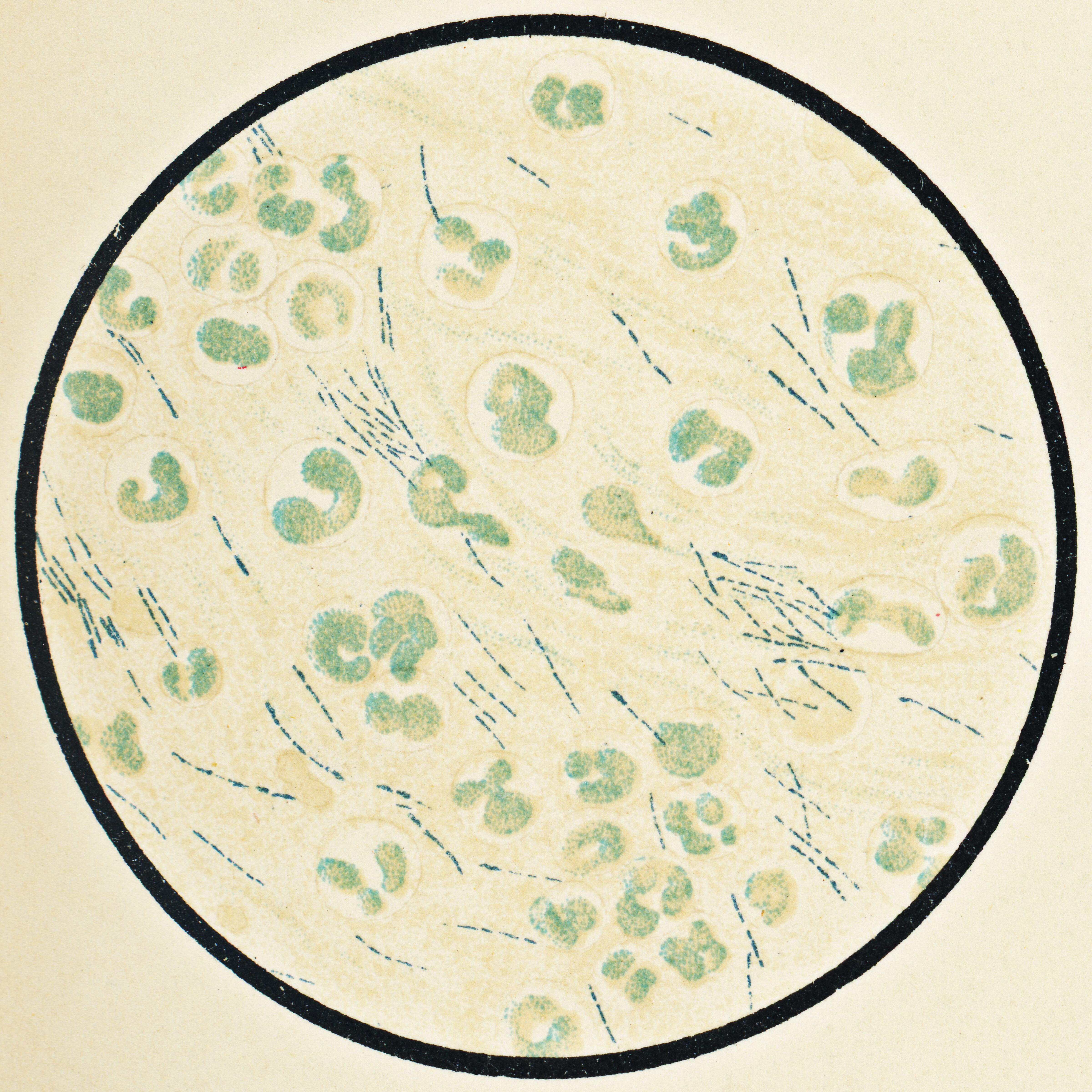 Esta bacteria guarda relación con la fibrosis quística.
