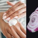 Las propiedades de la cebolla contribuyen a aclarar las manchas en las manos.