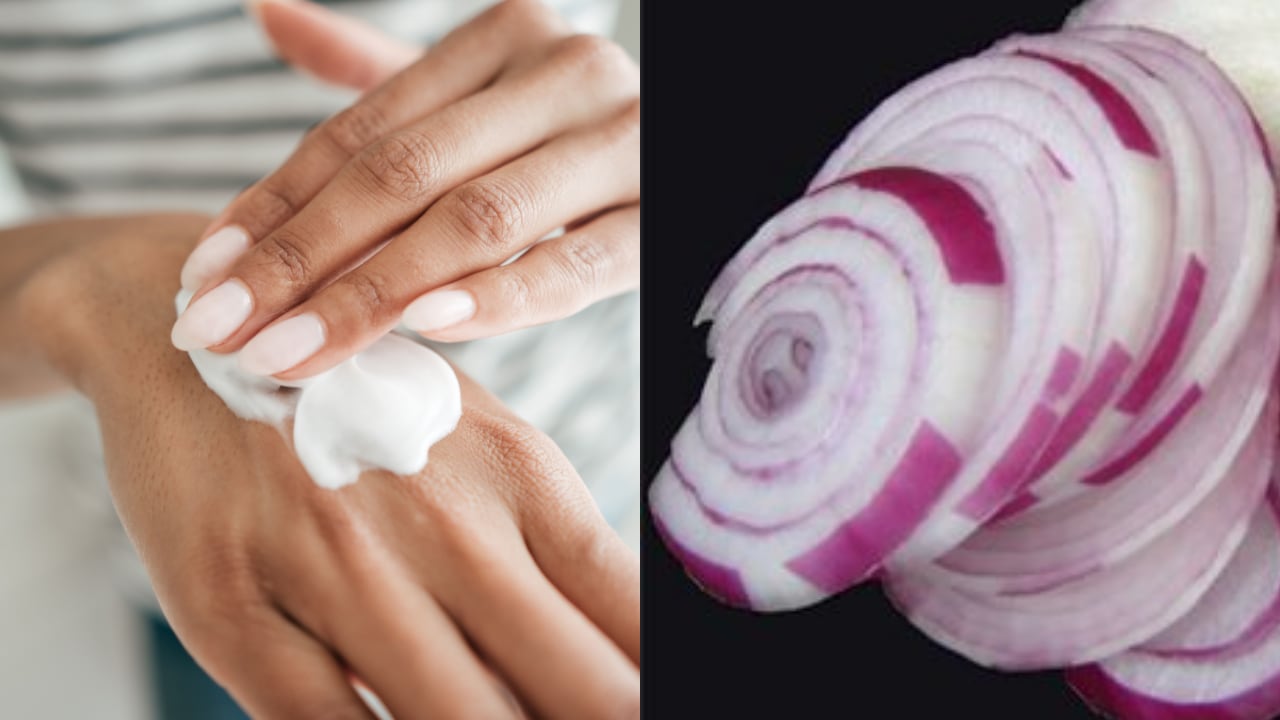 Las propiedades de la cebolla contribuyen a aclarar las manchas en las manos.