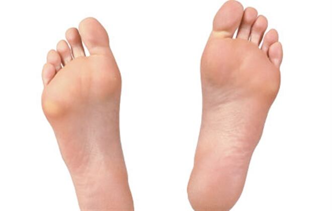 Sobre los dedos, aunque también en las puntas de éstos o en la planta del pie. 
