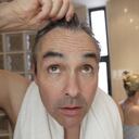 La caída del cabello no siempre es un presagio de la calvicie. Foto: GettyImages.