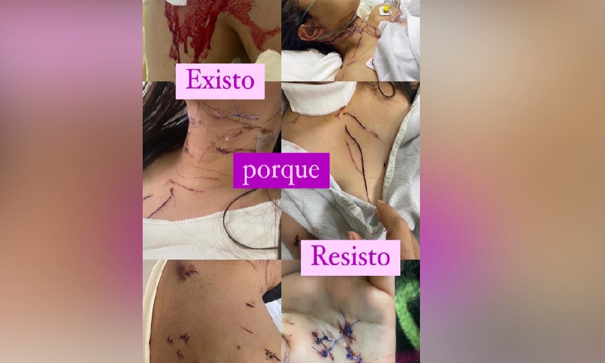 El agresor estuvo a pocos milímetros e afectar vasos sanguíneos vitales de la joven.