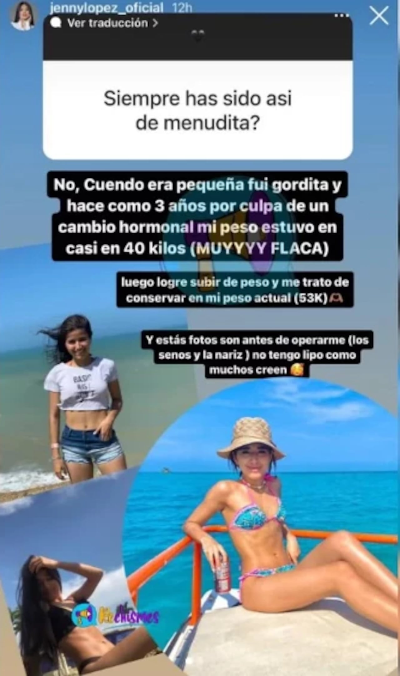 La cantante reveló que hasta el momento se ha practicado dos cirugías.