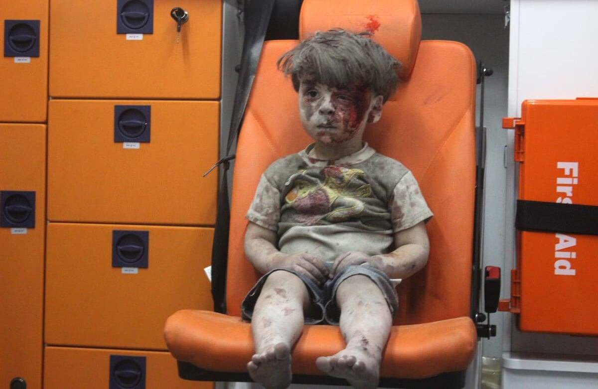 La imagen de Omran Daqneesh, niño de 5 años, cubierto de sangre y polvo, sacudió al mundo en 2016. En la imagen de video se ve al pequeño al interior de una ambulancia, aturdido y con la mirada perdida, luego de un bombardeo al norte de Alepo. Ocho personas murieron, cinco de ellos niños, entre ellos su hermano Ali. Por tratarse también de un niño, la imagen suele estar asociada con la de Aylan Kurdi, hallado muerto por ahogamiento en una costa del mediterraneo.  Foto: flickr.com / AMC
