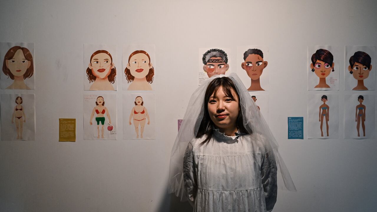 En lo momentos más fuertes de su anorexia, Zhang Qinwen pesaba 28 kilos, se le caía el cabello, apenas podía caminar y tenía problemas de visión. Estuvo al borde de la muerte.