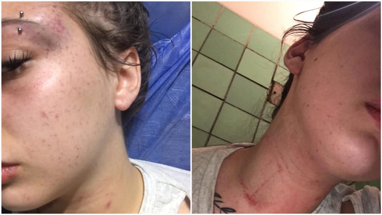 La joven simuló haberse desmayado para proteger su vida.