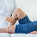 Las venas várices pueden generar complicaciones de salud, más allá de un problema estético.