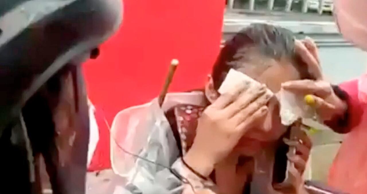 Joven herida en Suba durante las protestas del 28 de abril.