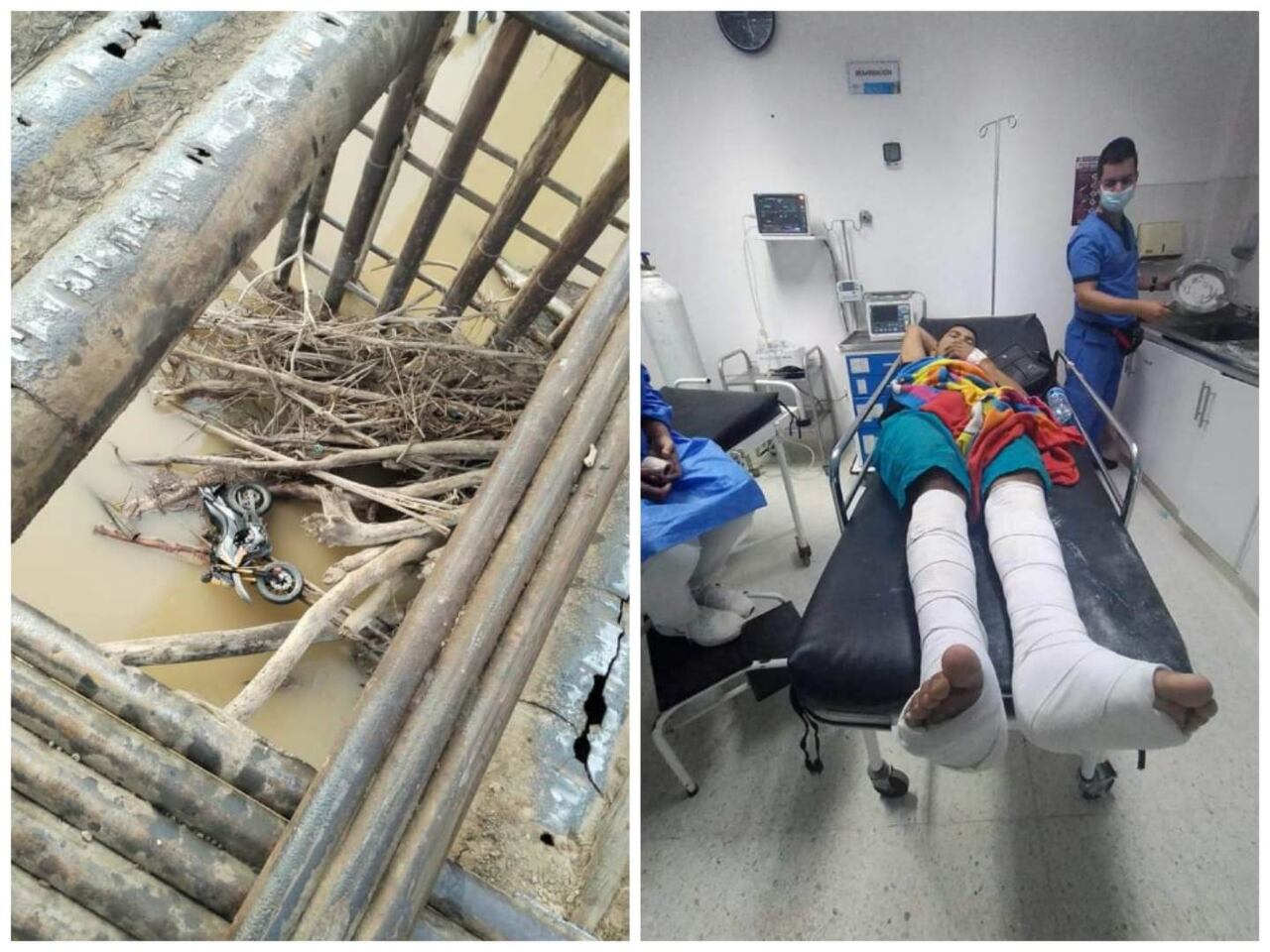 La víctima tuvo que ser intervenida quirúrgicamente.