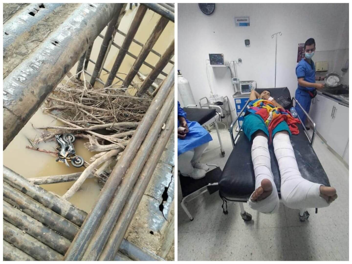 La víctima tuvo que ser intervenida quirúrgicamente.