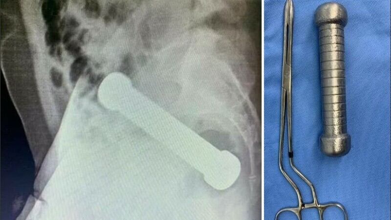 Pesa de 2 kilos extraída.