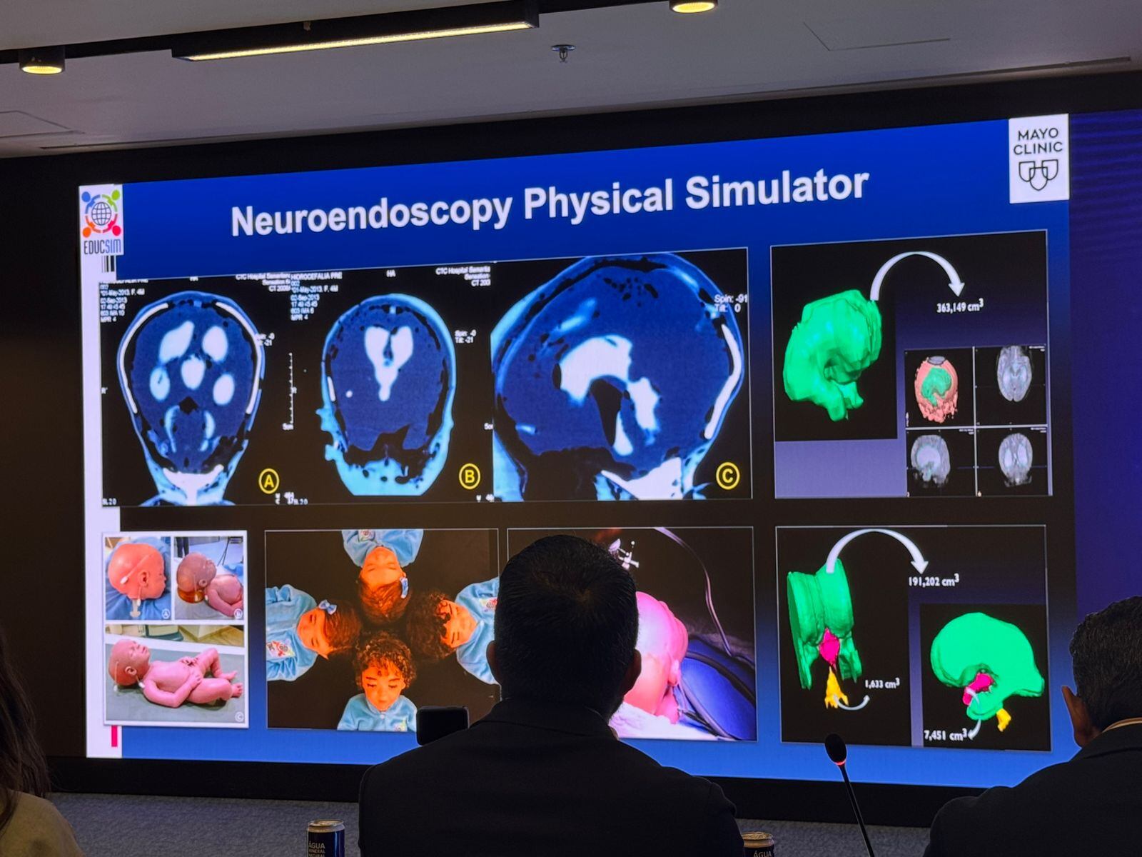 No es un paciente real, sino un simulador creado por la neurocirujana pediátrica brasileña Giselle Coelho.