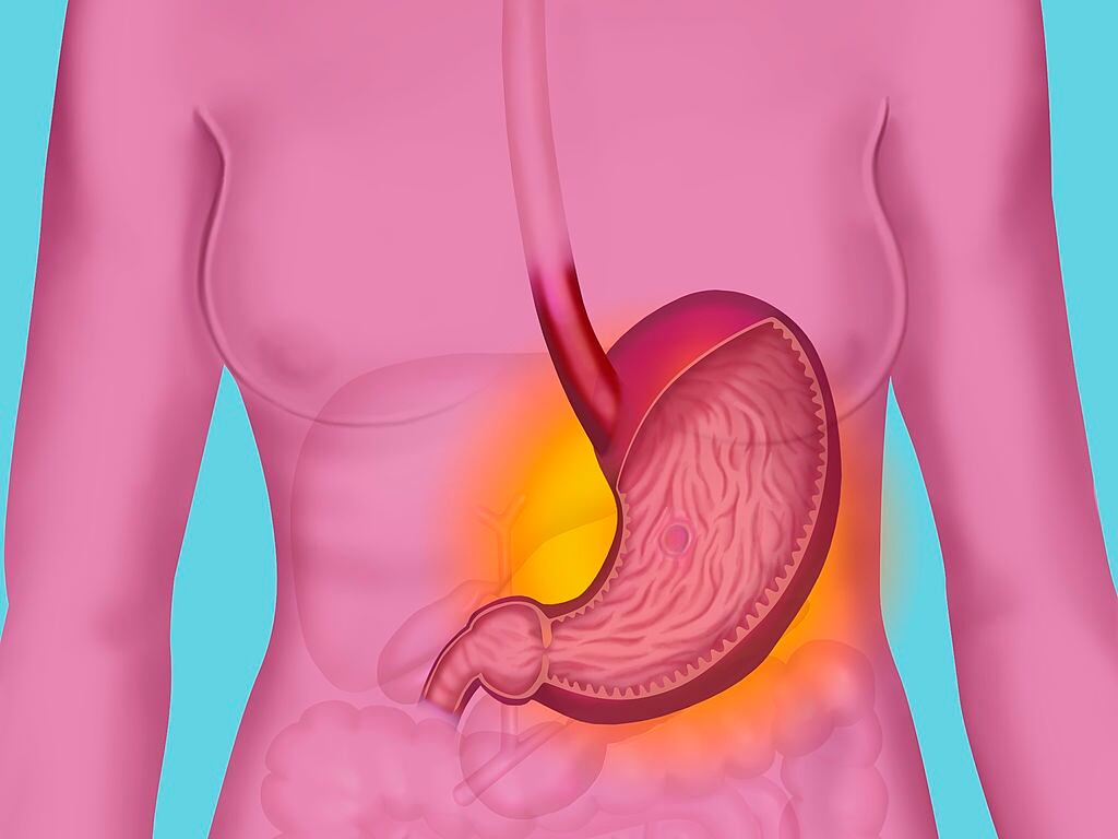 La gastritis puede aliviarse con algunas recomendaciones caseras.
