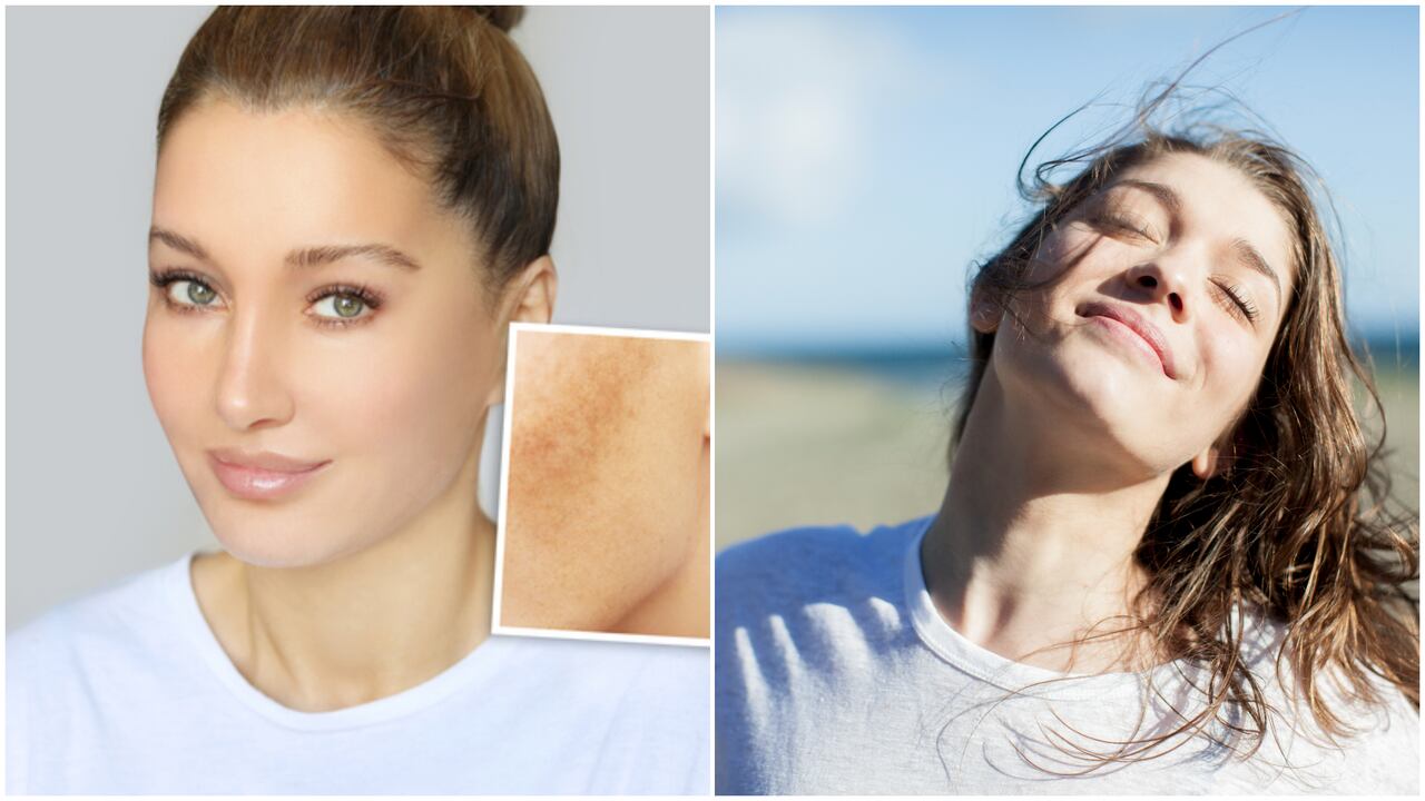 La exposición constante al sol sin protección puede ser dañina para la piel.