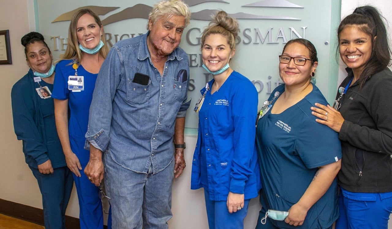 Así quedó el rostro de Jay Leno tras sufrir quemaduras hace unos días