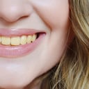 Es importante mantener una adecuada higiene dental.