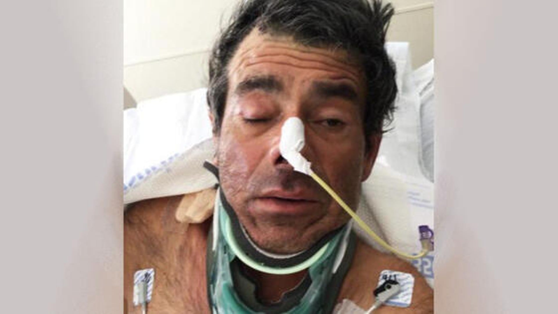 El hombre recibió el nombre de John Doe, el cual se les da a las personas no identificadas.