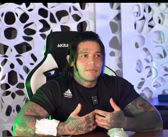 Yeferson Cossio se realizó un alargamiento de piernas y ha causado todo tipo de comentarios en redes sociales.