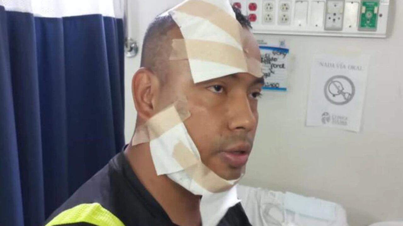 Ataque en ácido a policía en Ibagué