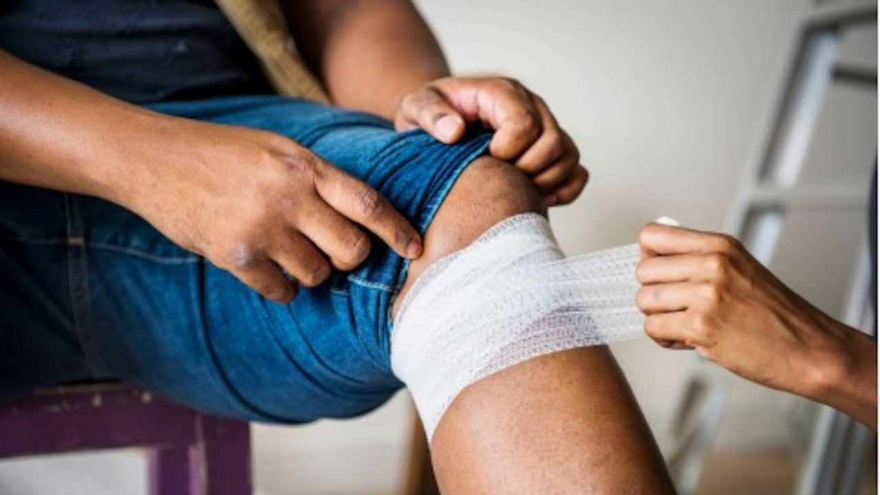 Alerta en Bogotá por incremento de ataques de animales potencialmente transmisores de rabia