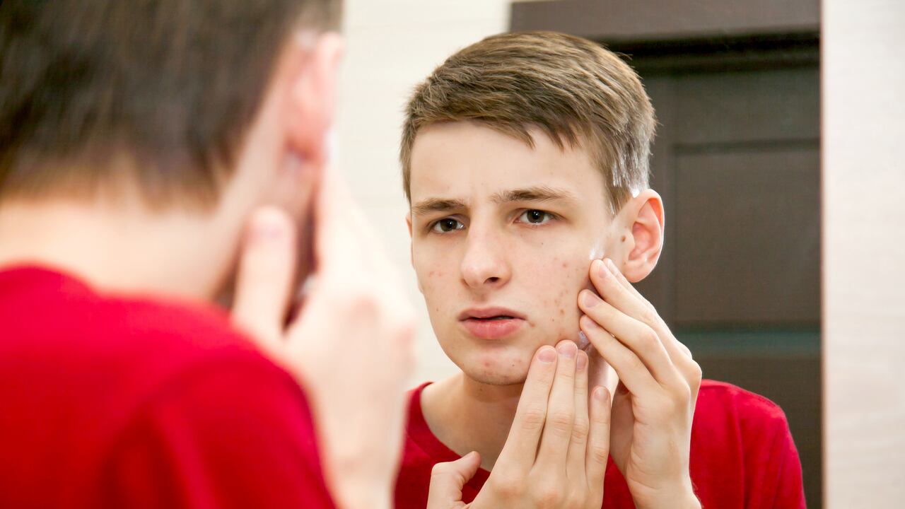 Cerca de un joven atractivo con piel problemática y cicatrices de acné se ve en el espejo del baño
