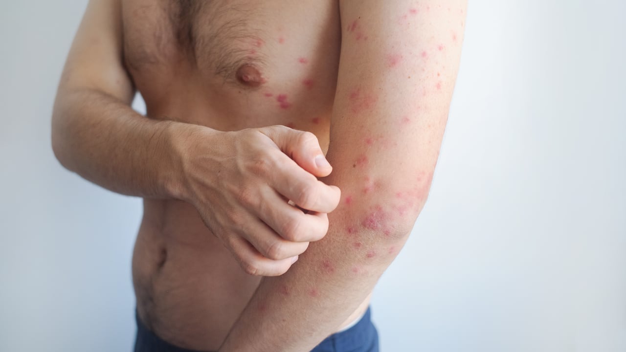 Las autoridades pusieron en marcha el cerco epidemiológico.