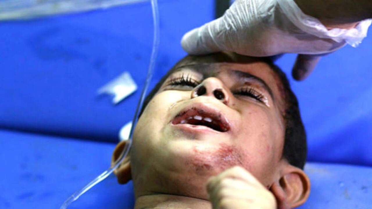Un niño herido en el hospital Al Shifa este 4 de agosto. Los médicos en Gaza dicen estar "más y más desesperados".