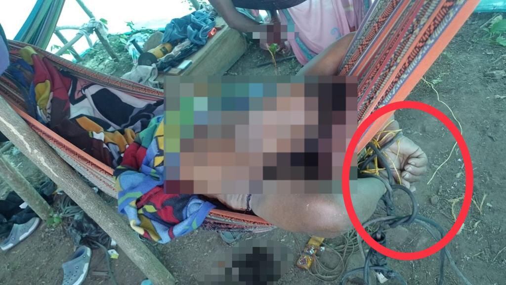 Una de las víctimas tenía una herida en la cabeza