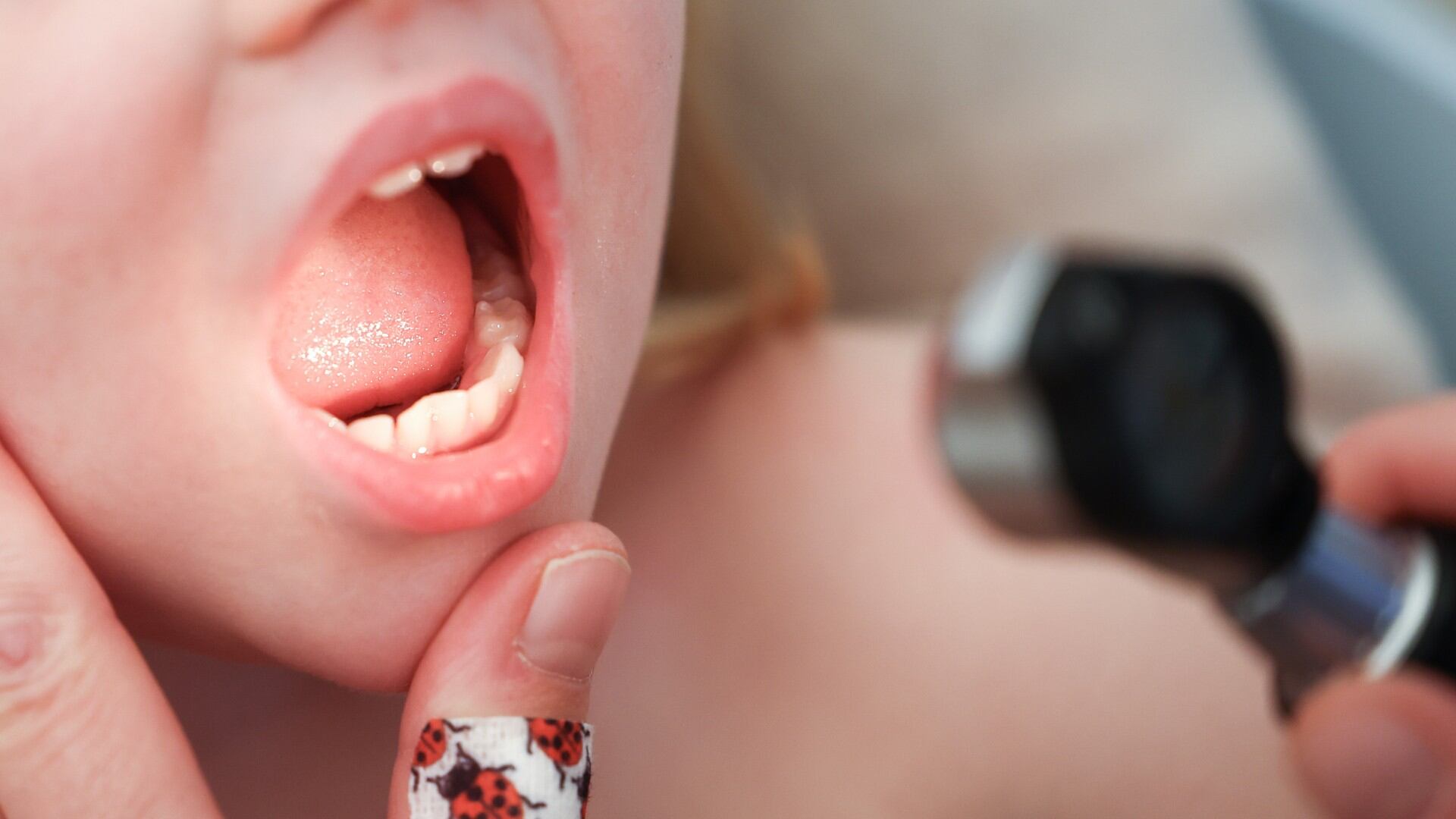 El dolor de garganta es uno de los síntomas más comunes con la llegada del invierno.