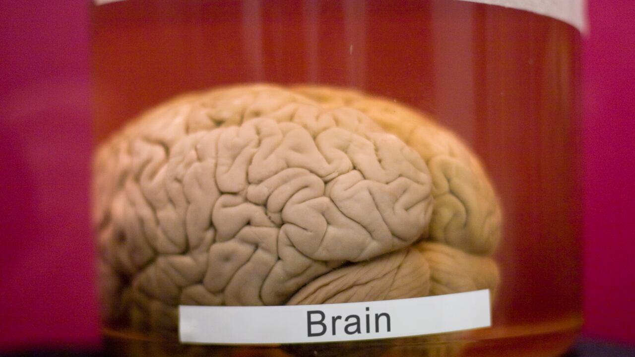 Los cerebros fueron coleccionados entre 1945 y 1982.