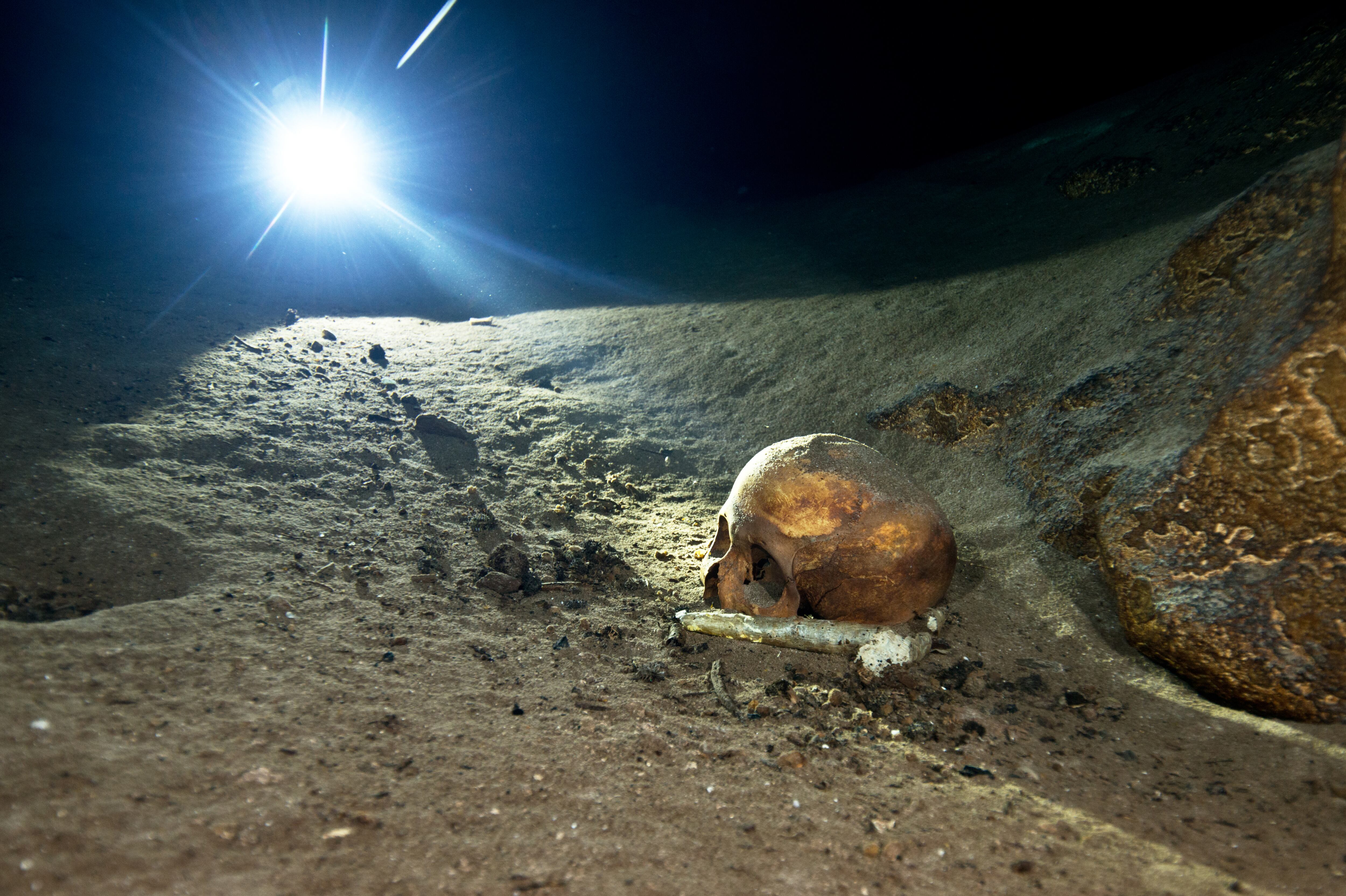 Investigaciones posteriores demostraron que esta forma del cráneo no era natural ni extraordinaria.