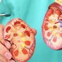 Son tres verduras las que se deben evitar para que no aparezcan los molestos cálculos renales