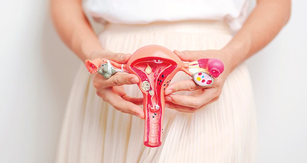 La endometriosis es una patología en la que “el endometrio, que es el forro interno del útero, se desprende todos los meses en forma de menstruación. Dicho tejido se puede alojar anormalmente en otros lugares como los ovarios; el forro del abdomen, llamado peritoneo; las trompas de falopio", explica un experto.