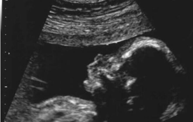 Cuando te realizan una ecografía, el médico puede visualizar a tu bebé en su ambiente intrauterino.