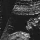 Cuando te realizan una ecografía, el médico puede visualizar a tu bebé en su ambiente intrauterino.