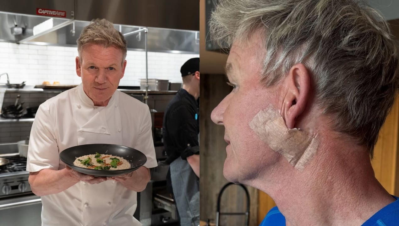 Gordon Ramsey fue diagnosticado con cáncer de piel