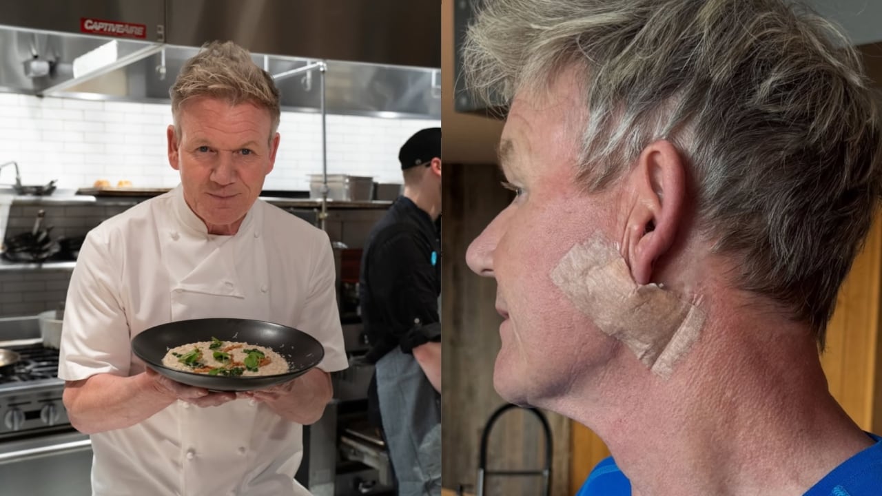 Gordon Ramsay fue diagnosticado con cáncer de piel