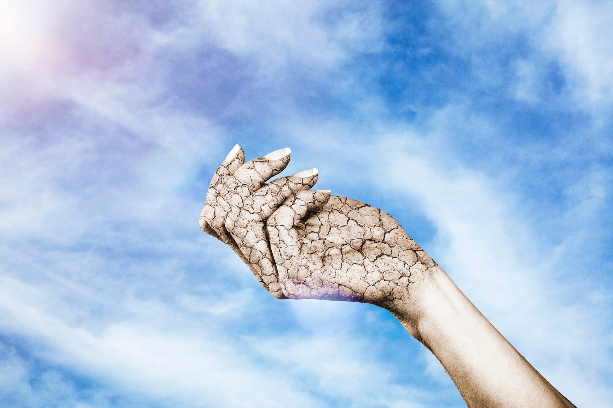 Existen métodos para combatir la resequedad en las manos.