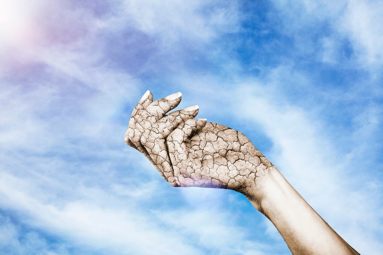 Existen métodos para combatir la resequedad en las manos.