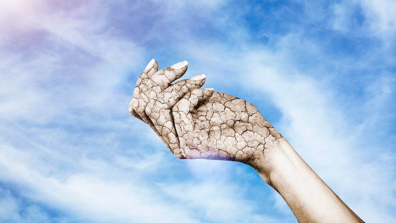 Existen métodos para combatir la resequedad en las manos.